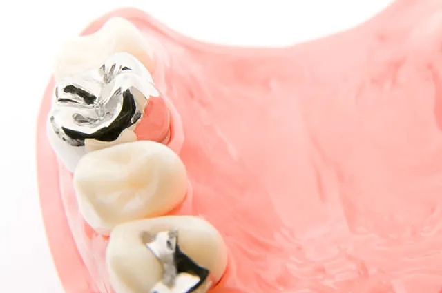 金属アレルギーの方へ