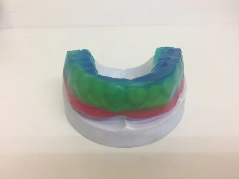 スポーツ用マウスピース